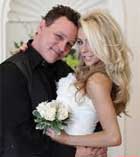 Πλαστική πριν το γάμο